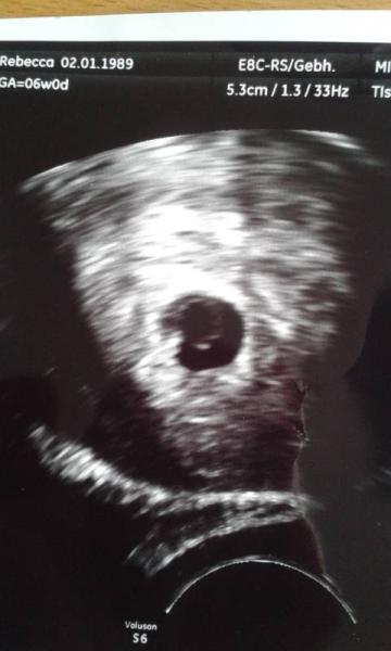 Bild zu 6+0 Das Herz schlägt schon :D - Forum für November - Mamis