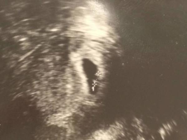 Bild zu Auch bei mir 1. FA-Termin :D - Forum für November - Mamis