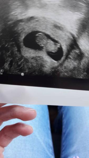 Bild zu 2. Termin beim gyn - Forum für November - Mamis