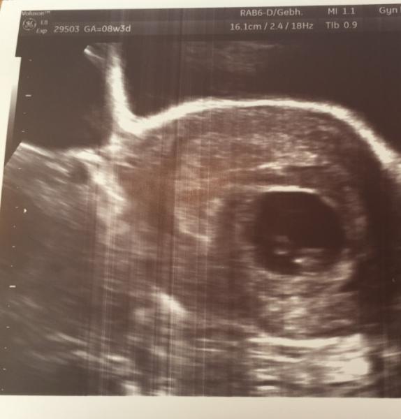 Bild zu Blutungen aufgehört juhu :-) - Forum für November - Mamis