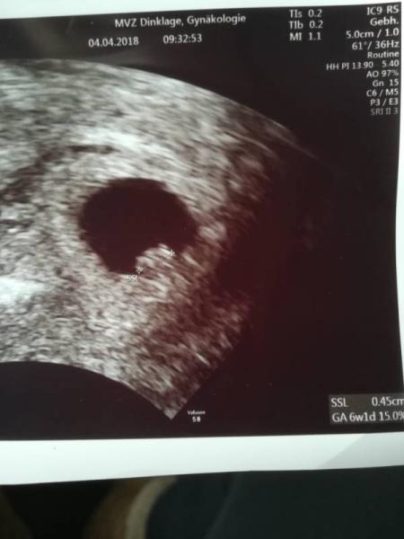 Bild zu Mein Baby - Forum für November - Mamis