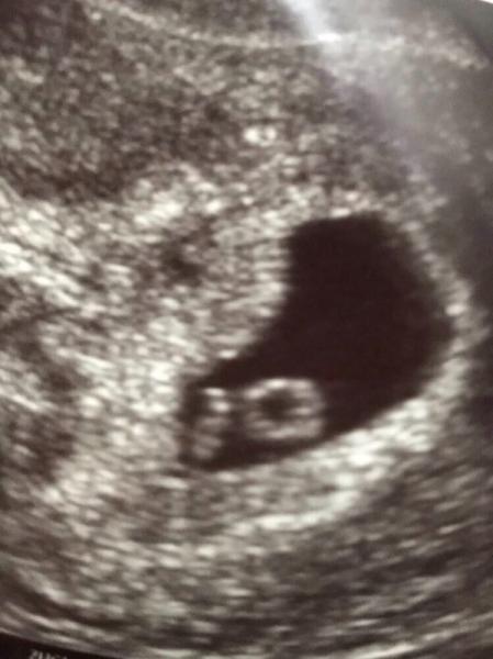 Bild zu Die 1. Ultraschallbilder - Forum für November - Mamis
