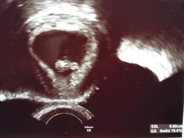 Bild zu Blub blub blub - Herzchen schlägt! :D - Forum für November - Mamis