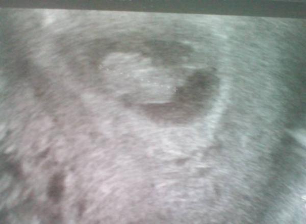 Bild zu 1. FA Termin - Forum für November - Mamis