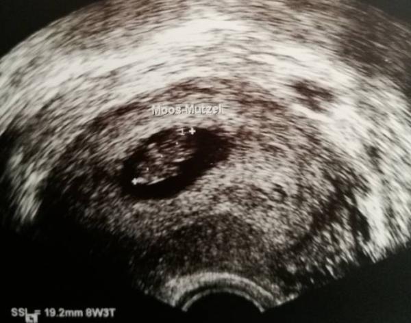Bild zu Die erste Vorsorgeuntersuchung ist geschafft!! - Forum für November - Mamis
