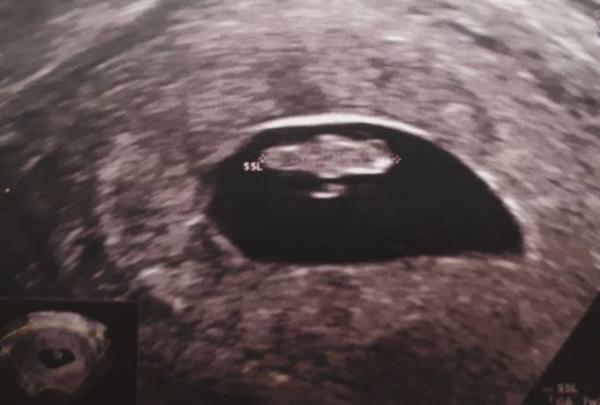 Bild zu Alles prima :) 1. Ultraschall - Forum für November - Mamis