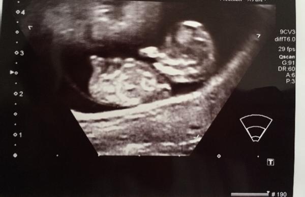 Bild zu Sooo erleichtert 😊 - Forum für November - Mamis
