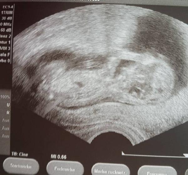 Bild zu Baby geht es super - Forum für November - Mamis