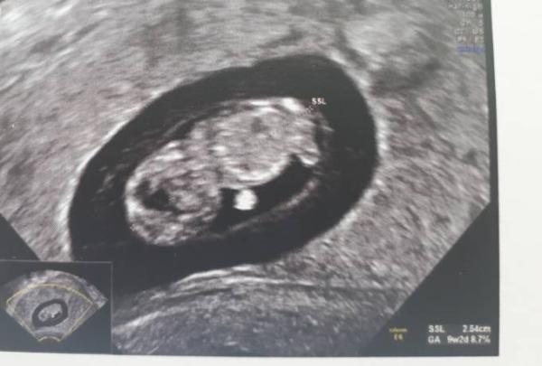 Bild zu Praenatest & es bewegt sich :) - Forum für November - Mamis