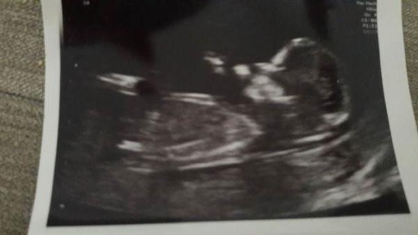 Bild zu FA Termin - Forum für November - Mamis