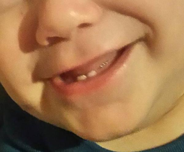 Bild zu