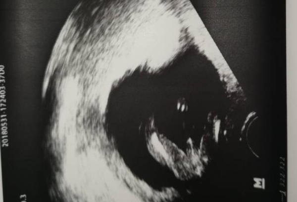 Bild zu Wer erkennt was? - Forum für November - Mamis