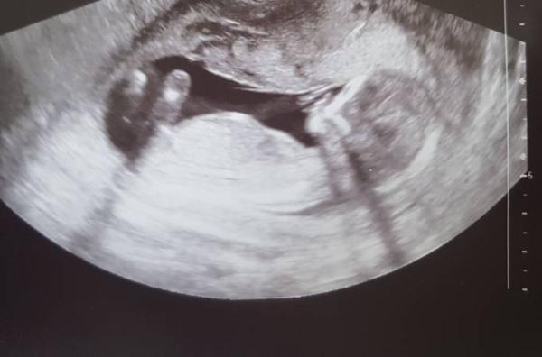Bild zu Wer kennt sich aus ??? Junge oder Mädchen??? :) - Forum für November - Mamis