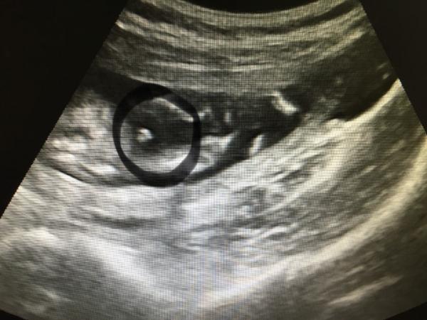 Bild zu Auch Outing endlich.... - Forum für November - Mamis