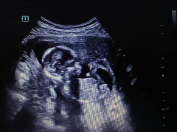 Bild zu Mädchen oder Junge? - Forum für November - Mamis