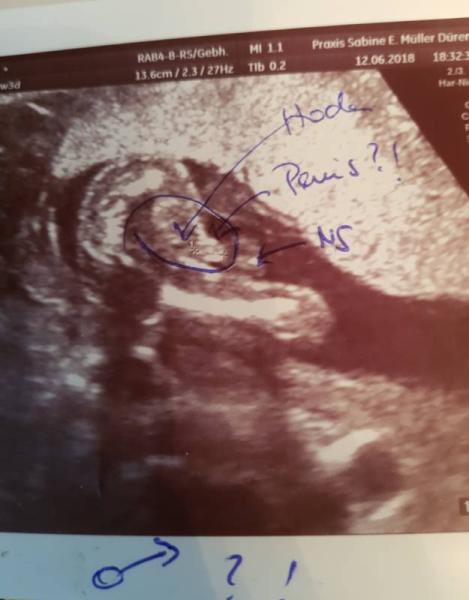 Bild zu Mädchen oder Junge - Forum für November - Mamis