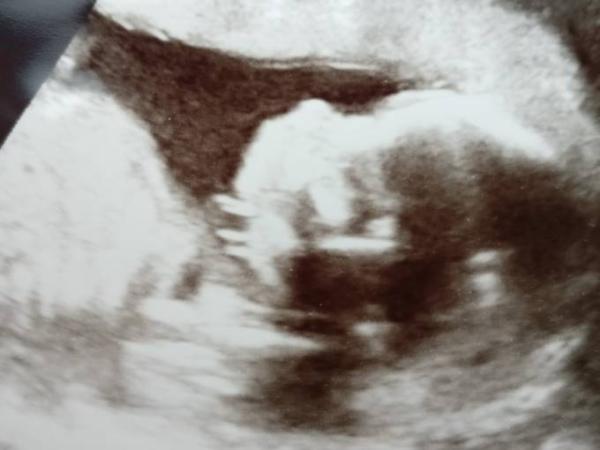 Bild zu heute Halbzeit, US und erster Tritt! :) - Forum für November - Mamis