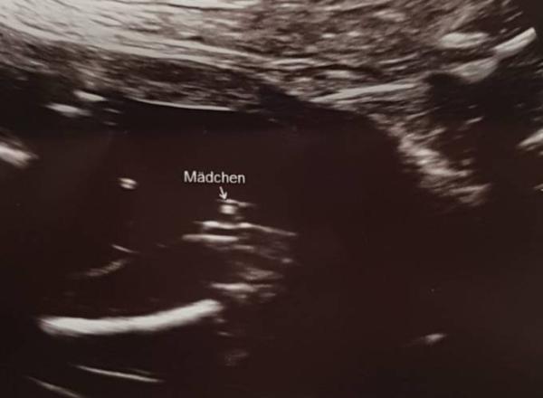 Bild zu Outing beim Organscreening - Forum für November - Mamis