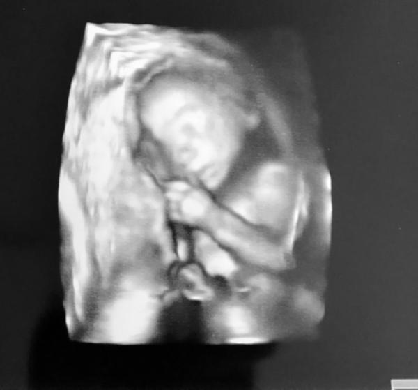 Bild zu Melde mich auch mal wieder 😀 - Forum für November - Mamis