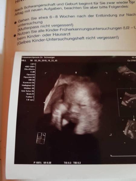 Bild zu Heute 3 d Ultraschall - Forum für November - Mamis