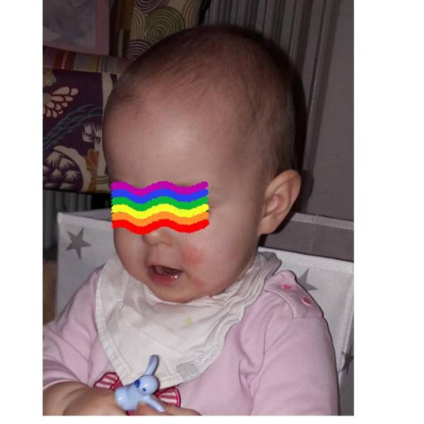 Bild zu Hautprobleme - Forum für November - Mamis