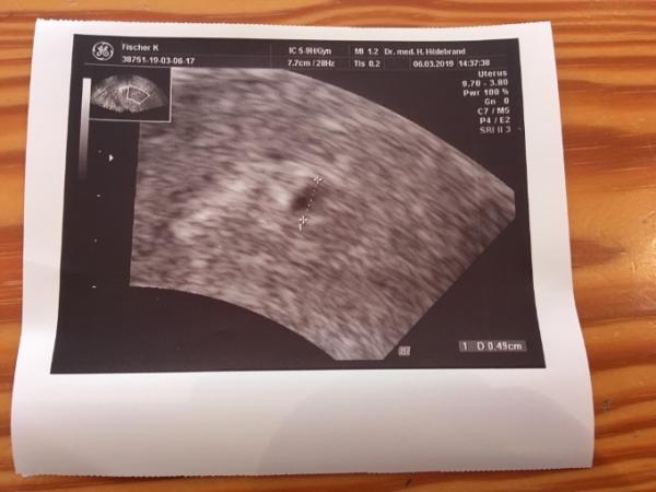 Bild zu Habt ihr schon einen ET? - Forum für November - Mamis
