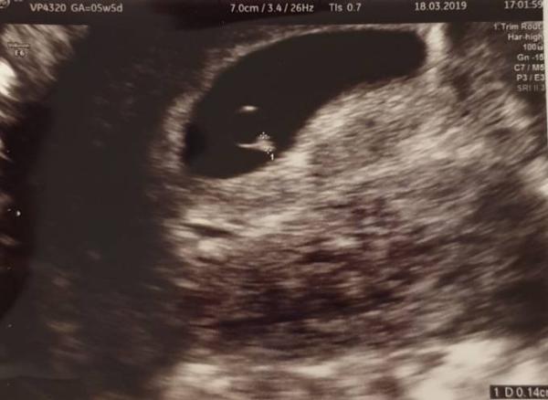 Bild zu Leises Hallo - Forum für November - Mamis
