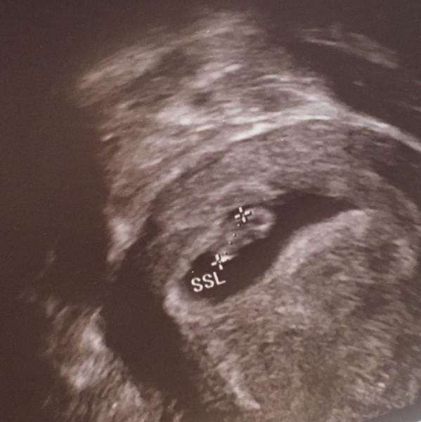Bild zu Zurück vom FA ❤️ - Forum für November - Mamis