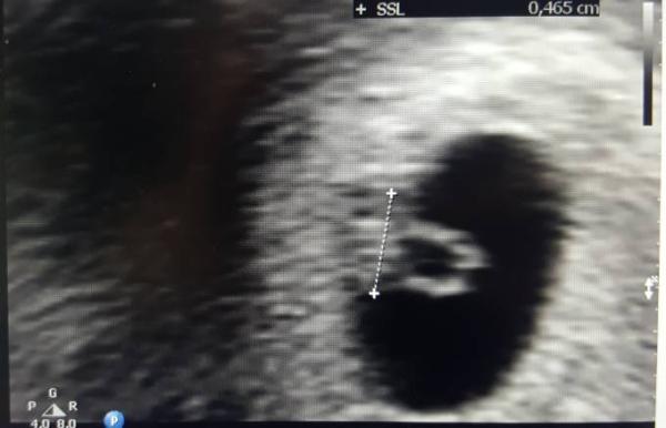 Bild zu :) - Forum für November - Mamis