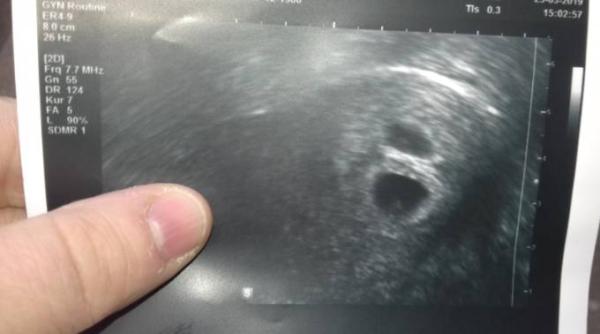 Bild zu Verwirrt ohne Ende - Forum für November - Mamis