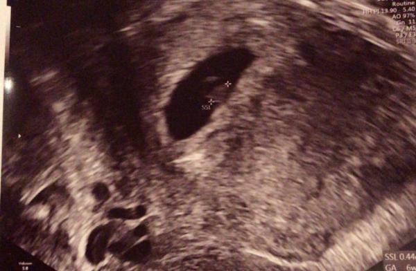 Bild zu Erleichterung ❤️ - Forum für November - Mamis