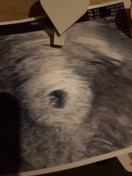 Bild zu Verzweifelt - Forum für November - Mamis
