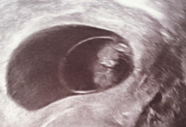 Bild zu Grüße vom Gummibärchen < 3 - Forum für November - Mamis