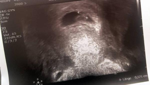 Bild zu Größe eurer Würmchen 🐛 - Forum für November - Mamis