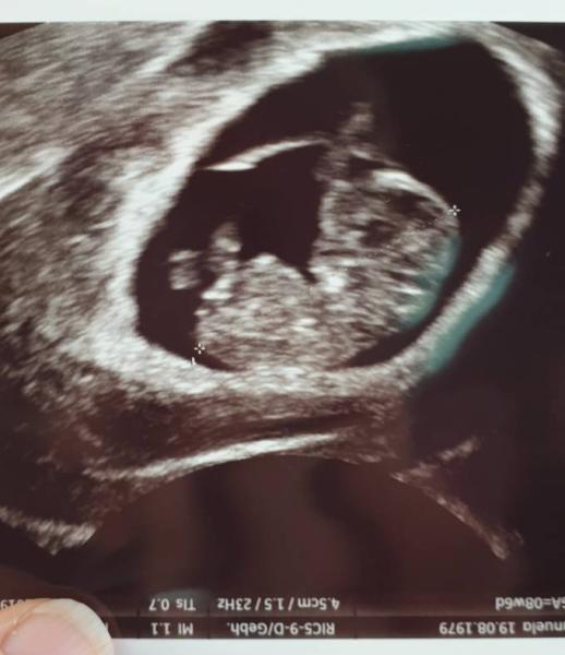 Bild zu vielleicht klappts beim 4. Versuch - Forum für November - Mamis