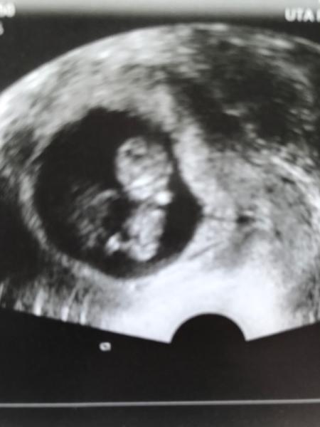 Bild zu Zurück vom Frauenarzt - Forum für November - Mamis