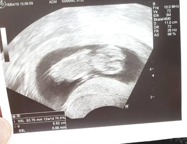 Bild zu Juhuu 12+0 und Ultraschalltermin :) - Forum für November - Mamis