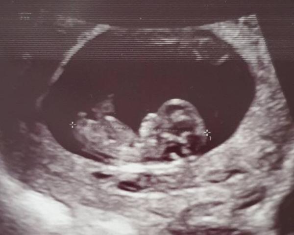 Bild zu Auch vom wöchentlichen Termin zurück - Forum für November - Mamis