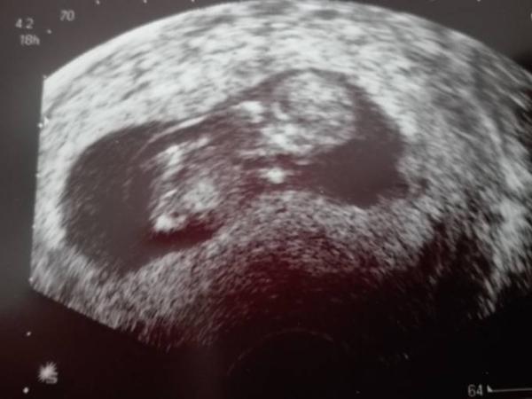 Bild zu Auch zurück Arzt... - Forum für November - Mamis