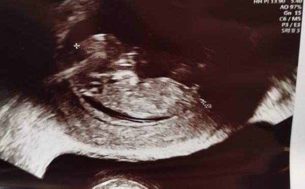 Bild zu Zurück vom Fa - Forum für November - Mamis