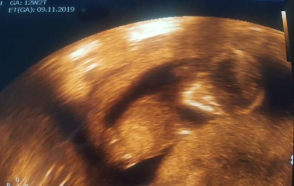 Bild zu Hallo 4. Monat 😍 - Forum für November - Mamis