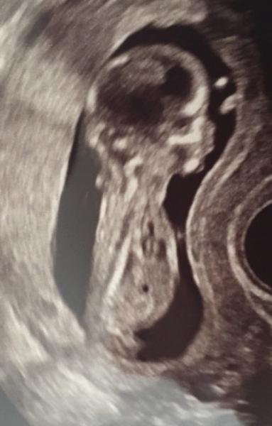 Bild zu Zurück vom FA - Forum für November - Mamis