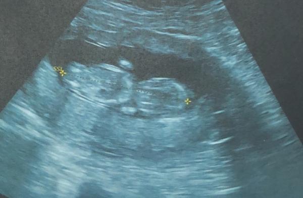 Bild zu Hallo 4. Monat oder auch Woche 14 - Forum für November - Mamis