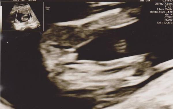 Bild zu Hallo 4.Monat! - Forum für November - Mamis