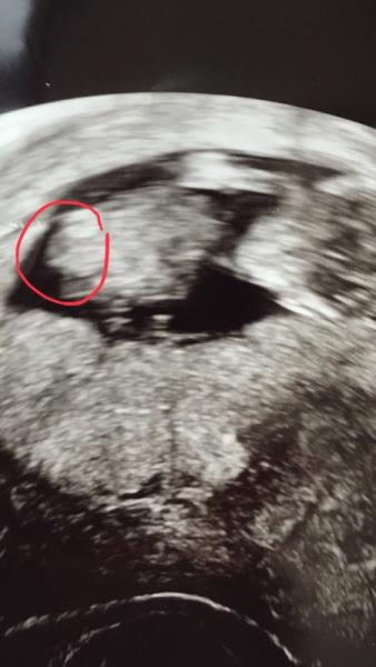 Bild zu Geschlecht erkennbar? - Forum für November - Mamis
