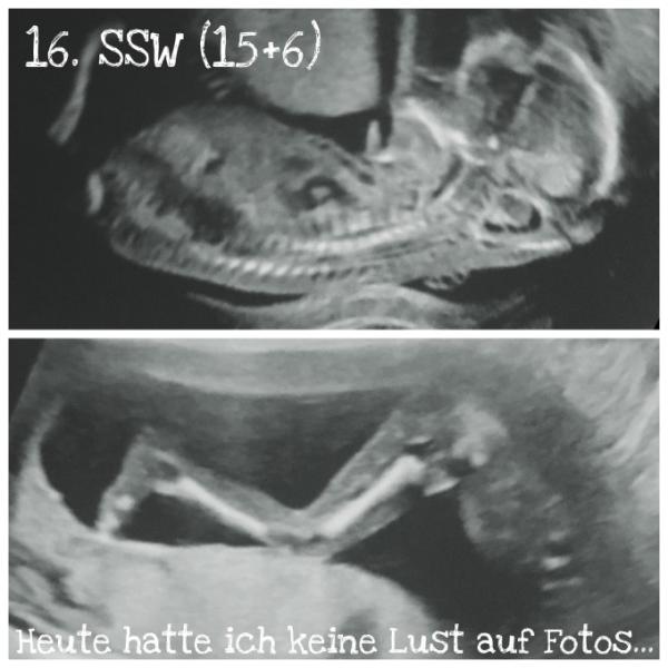 Bild zu zurück vom Termin und Hello 5. Monat! - Forum für November - Mamis