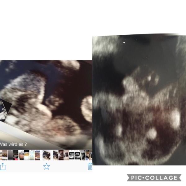 Bild zu Geschlecht - Forum für November - Mamis