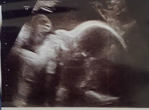 Bild zu Blutung, Bauchkrämpfe & ein aktives Baby - Forum für November - Mamis