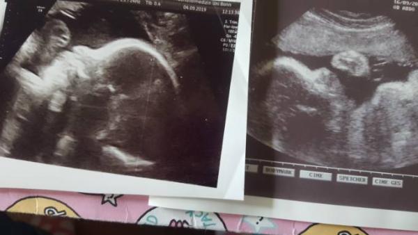 Bild zu Gewicht & Größe Eurer Babies? - Forum für November - Mamis