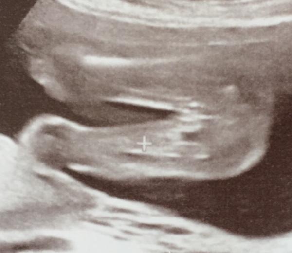 Bild zu Frage zu Outing (aus dem Februar Bus) - Forum für November - Mamis